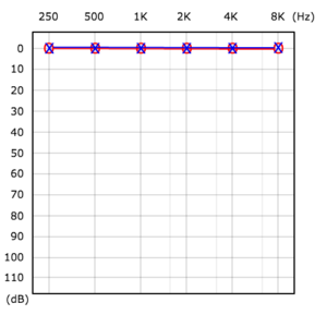 Audiogram?-How To Read a Hearing Test - Pro Fit Hearing