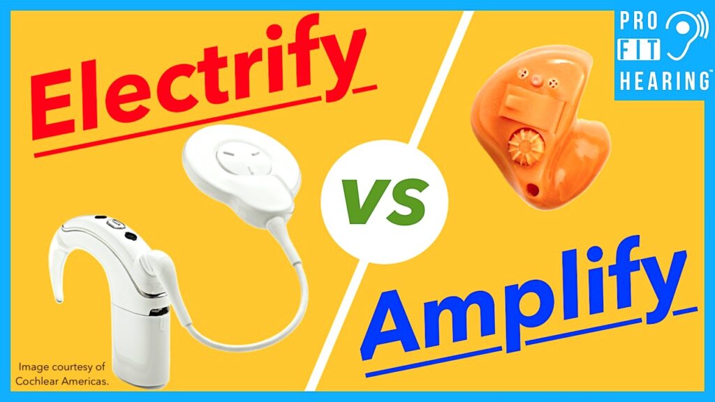 ELECTRIFYING Technology! - Cochlear Implants vs Hearing Aids