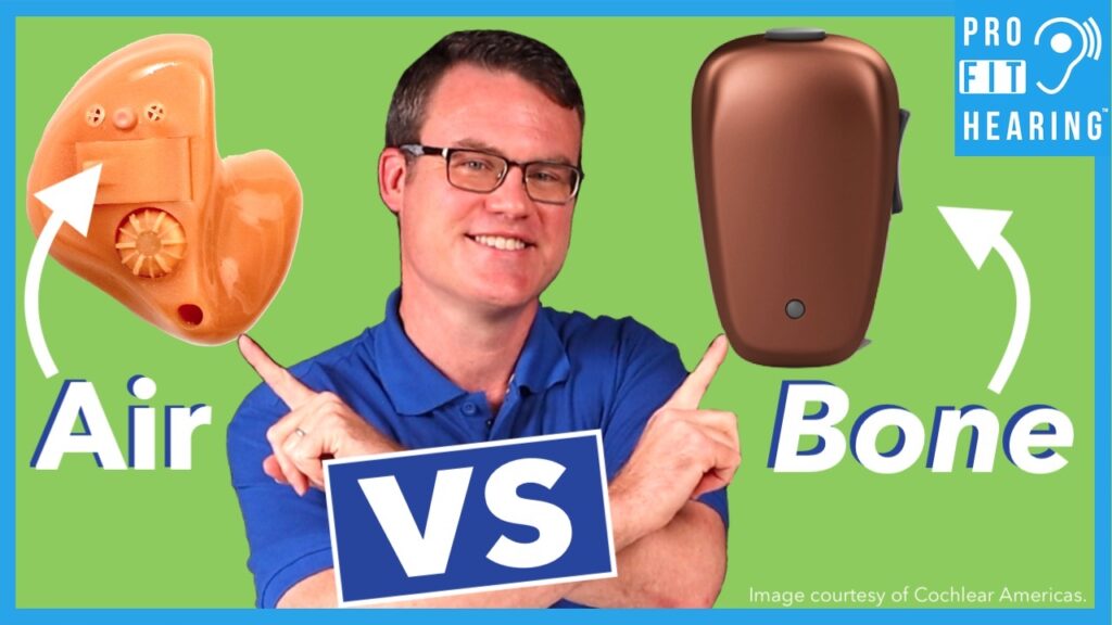 Bone Anchored Hearing Aid (BAHA) vs Hearing Aid